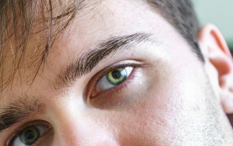 Sú vaše oči v poriadku? Všímajte si príznakov